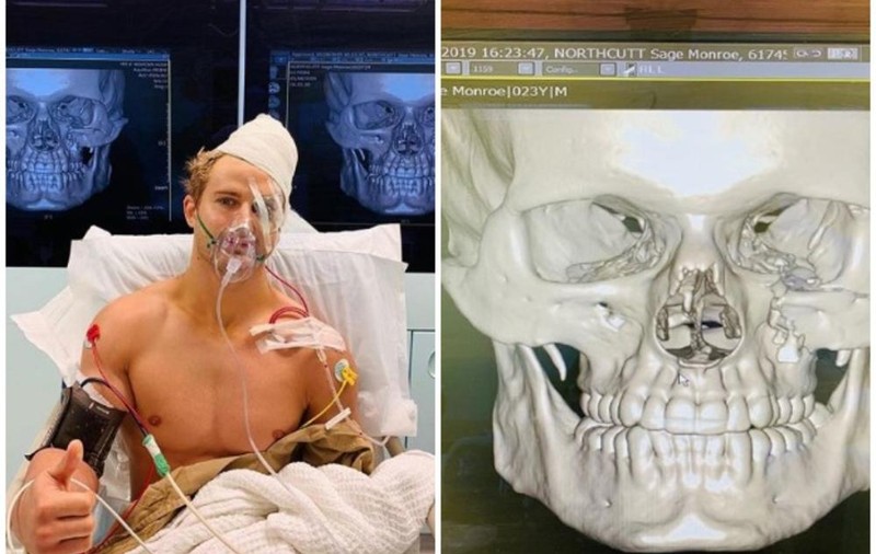 VIDEO | Debut cu ghinion în MMA: în 29 de secunde, brazilianul Sage Northcutt a fost făcut KO, lovitura i-a produs opt fracturi ale craniului și l-a băgat într-o operație de nouă ore