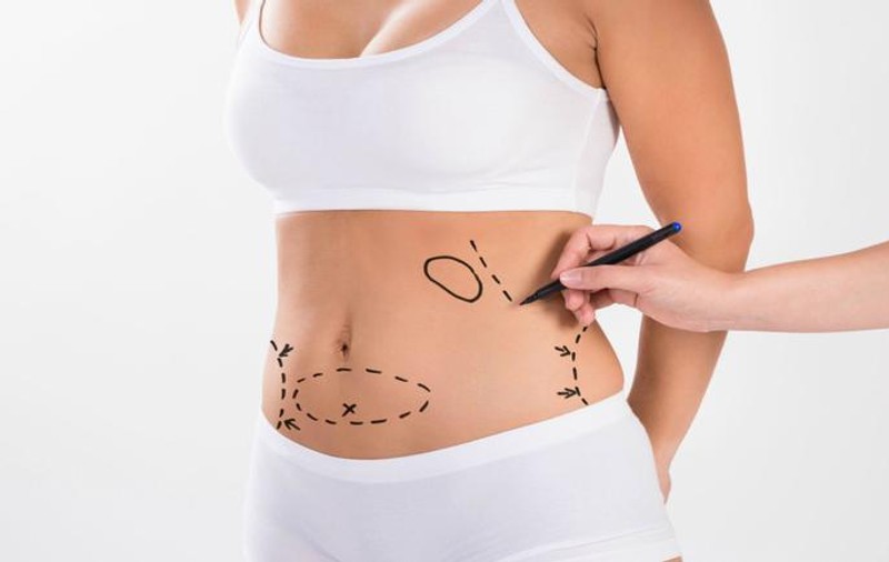 Ana Maria Crăciun a murit în Italia, în urma unei operații de liposucție. Tânăra din Galați avea doar 36 de ani