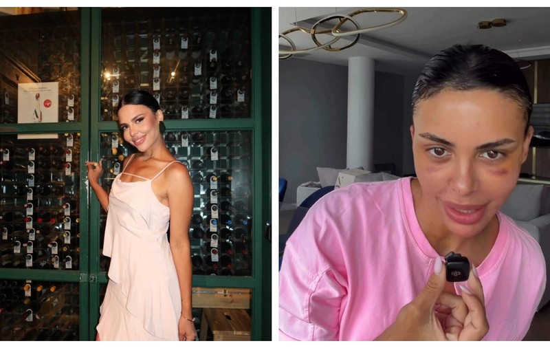 Imagini cu Andreea Popescu după intervențiile estetice. Ce a schimbat vedeta la ea. „Mi-a căzut părul. Pielea a arătat horror”