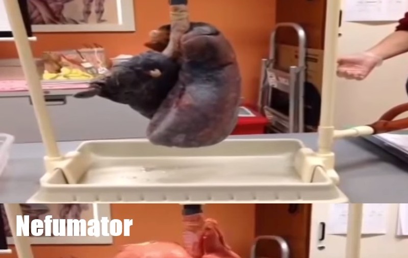 Cum arată plămânii unui fumător când respiră. VIDEO