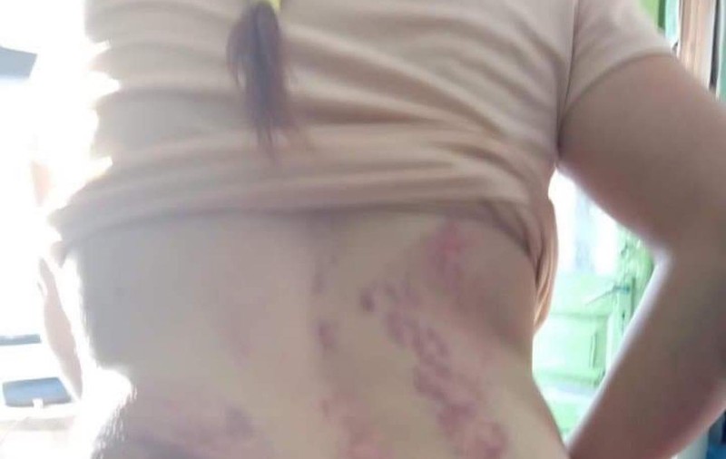 O femeie însărcinată, victima unor violențe extreme: bătută cu lanțul și sechestrată de concubin