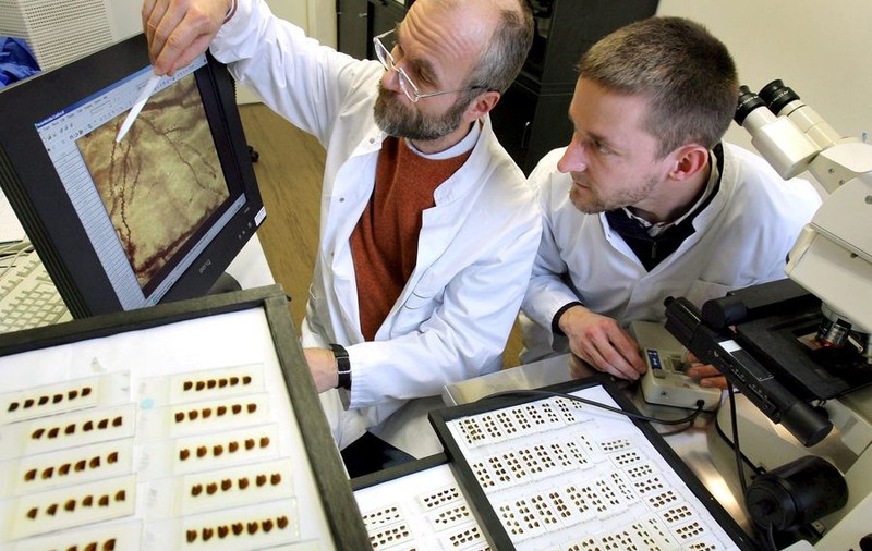 Alzheimer poate fi diagnosticată prin control oftalmologic