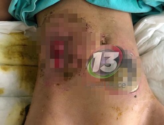 Rănile pe care le avea fetița i-au îngrozit pe medici. Foto: Canal Trece