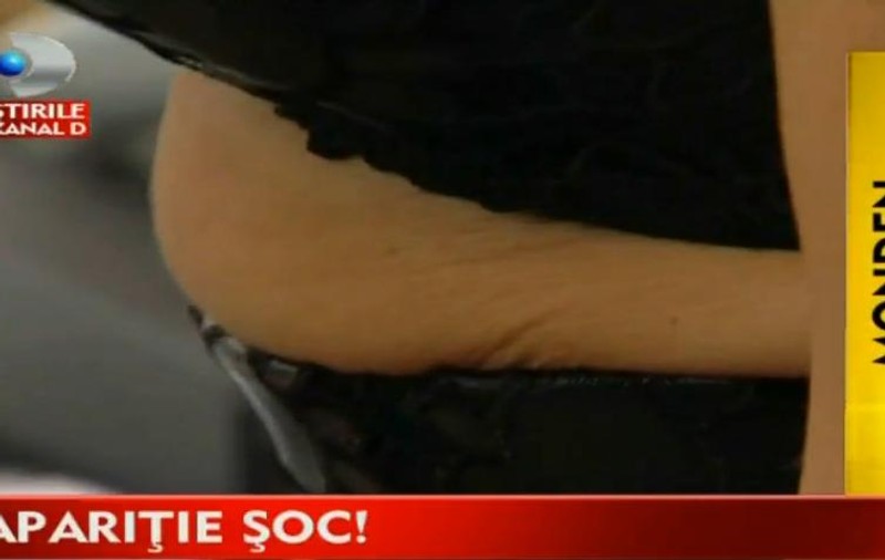 APARIȚIA cu care NICOLETA LUCIU A ȘOCAT ! Pielea de pe BURTĂ arată ca a UNEI BĂTRÂNE: este lăsată, crăpată și deshidratată!