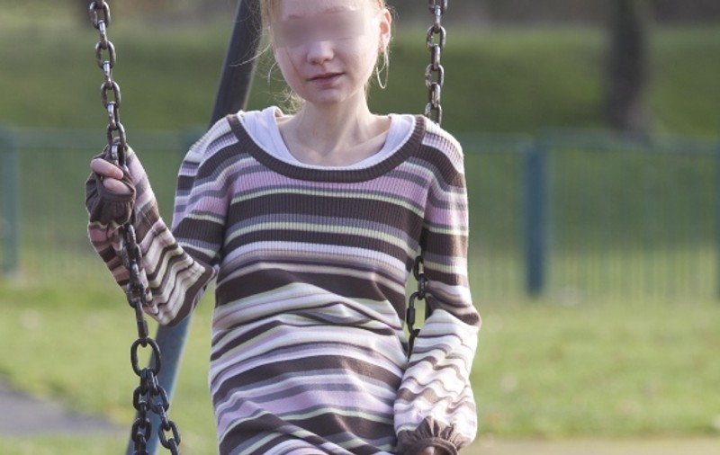 Anorexicii îşi pot pierde o parte din creier