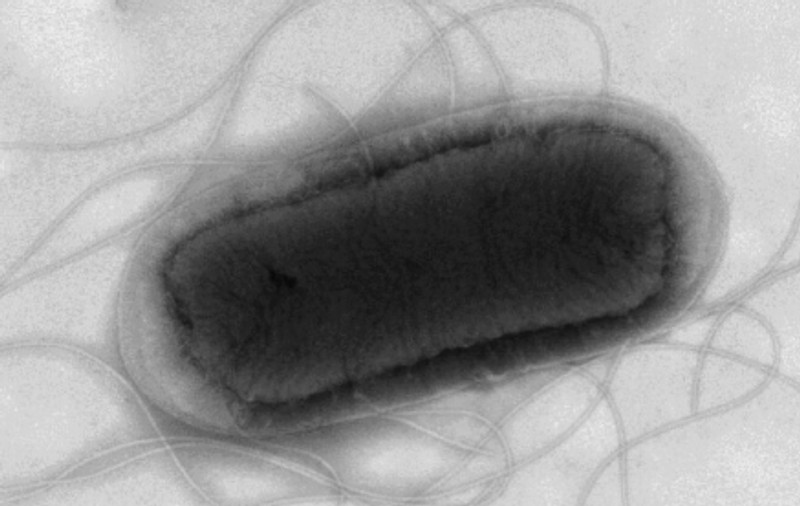 Focar mortal de E.coli în Marea Britanie: cel puţin un deces din cauza unei variante periculoase a bacteriei