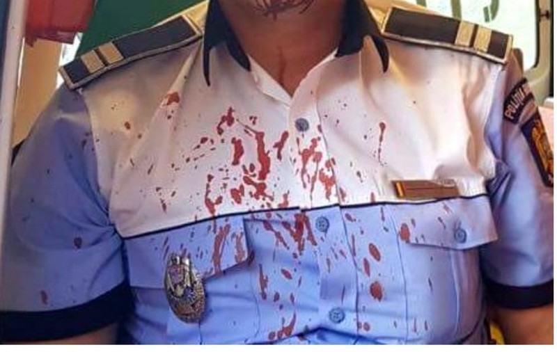 Un polițist vasluian a ajuns la spital după ce s-a dus să pună în aplicare un ordin de protecție!