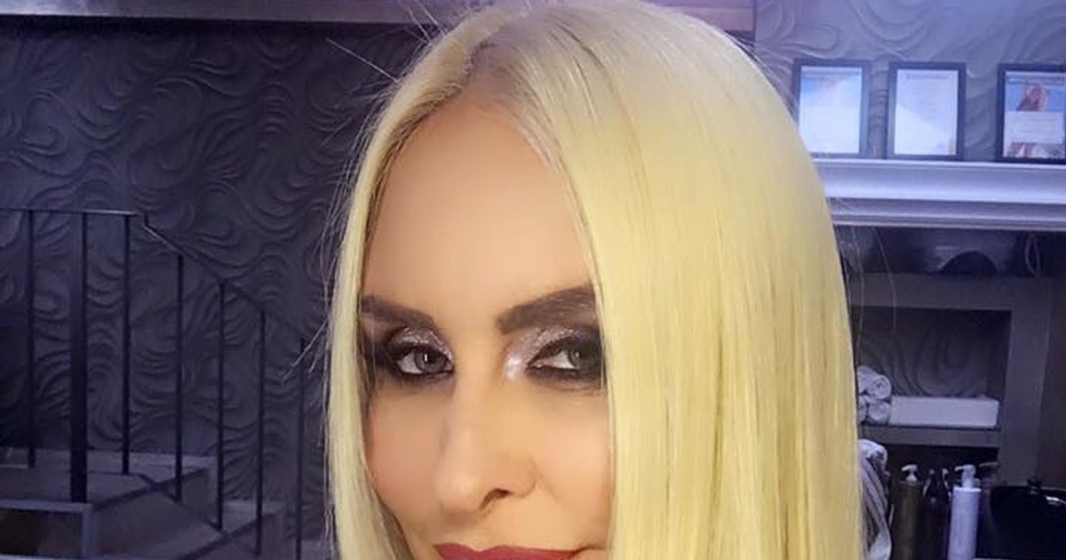 Vica Blochina si-a operat nasul. Blonda era nemultumita de felul în care arata
