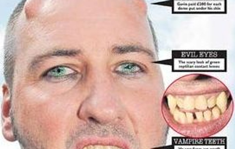 A investit 3.500 de lire în operaţii ca să semene cu Diavolul