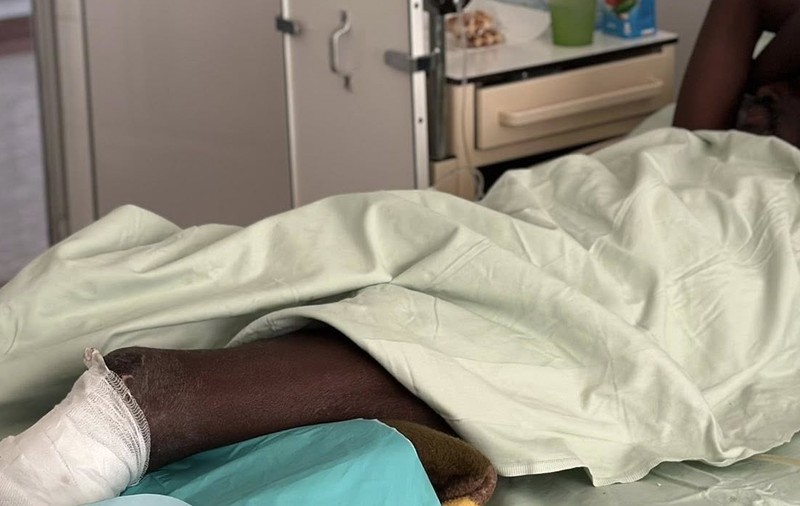 Trei migranți care au vrut să ajungă în Croația prin munți au rămas fără picioare, din cauza degerăturilor severe