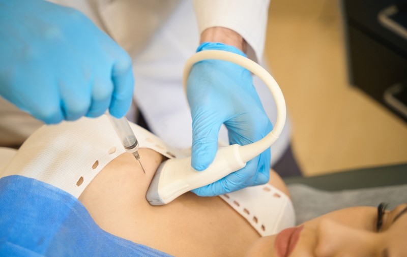 Cum se desfășoară o biopsie la sân și cât durează