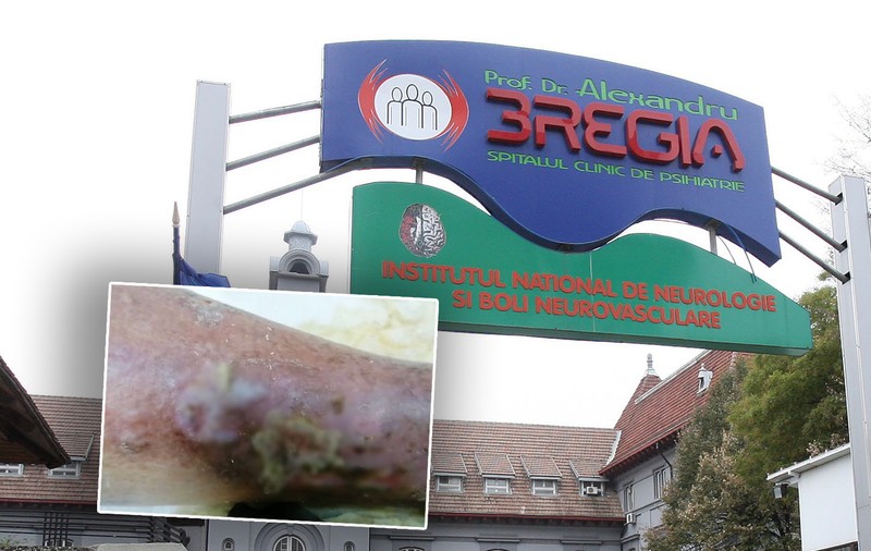 Medicul care a semnalat cazul viermilor de la „Obregia” se revoltă, după ce spitalul a negat existența lor: „Publicați acest drept la replică și documentele doveditoare”