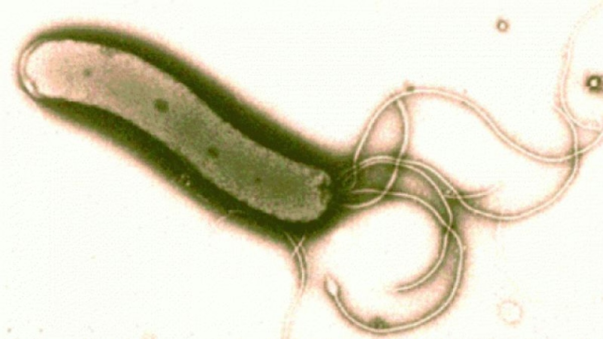 Bacterie la spitalul județean Craiova