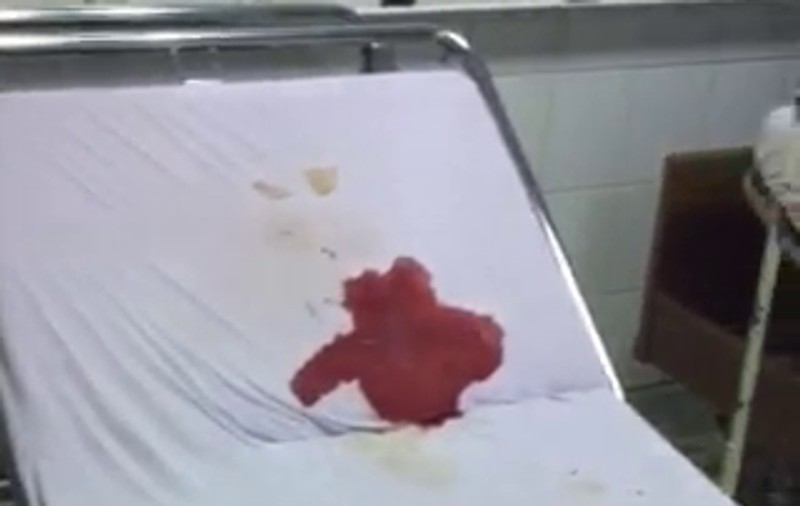 EXCLUSIV/ Încă o poveste revoltătoare a unui copil răpus de rujeolă. Hulitul spital din Reșița, suspectat ca a infectat cu rujeolă o fetiță de doi ani