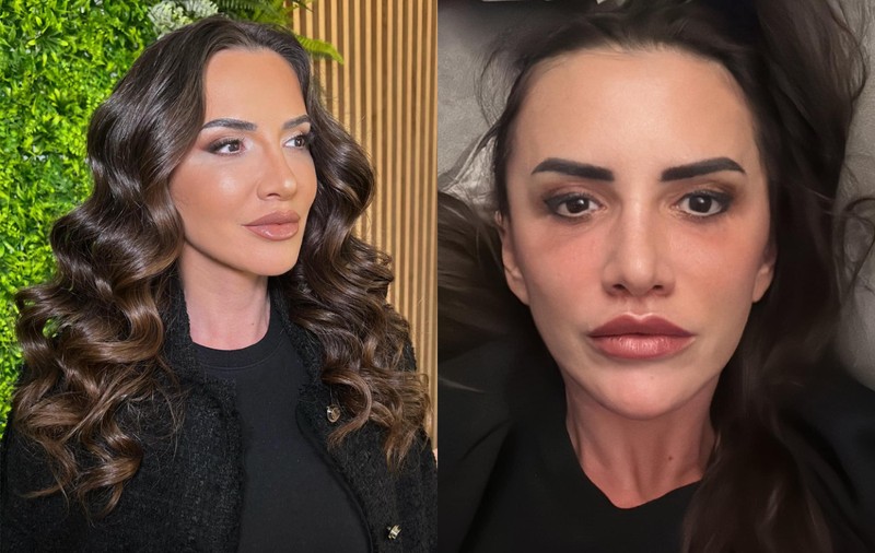 Cât au costat-o pe Mara Bănică operațiile estetice la față: „Mi-am făcut și un lip lift”. De ce îi e teamă să zâmbească și să poarte cercei