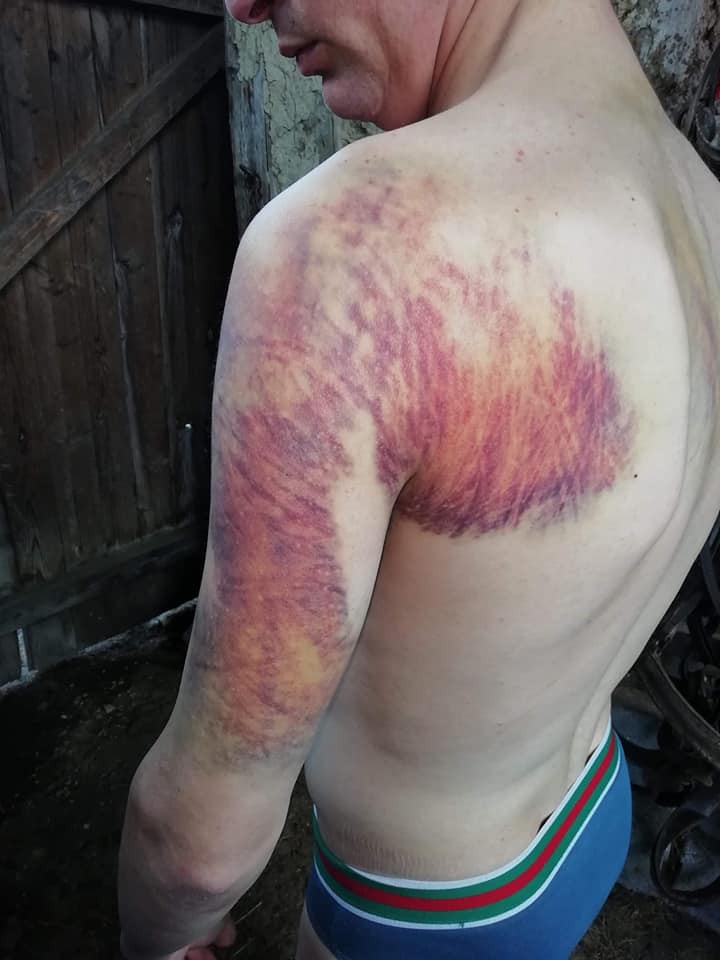 Așa arăta tânărul la câteva zile după ce a fost bătut