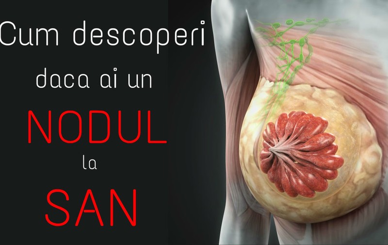 Cum descoperi dacă ai un nodul la sân