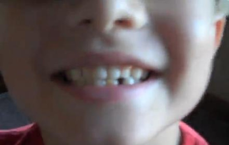 Cel mai curajos puşti?! Îşi scoate singur un dinte cu..."arma"! VIDEO DEMENŢIAL