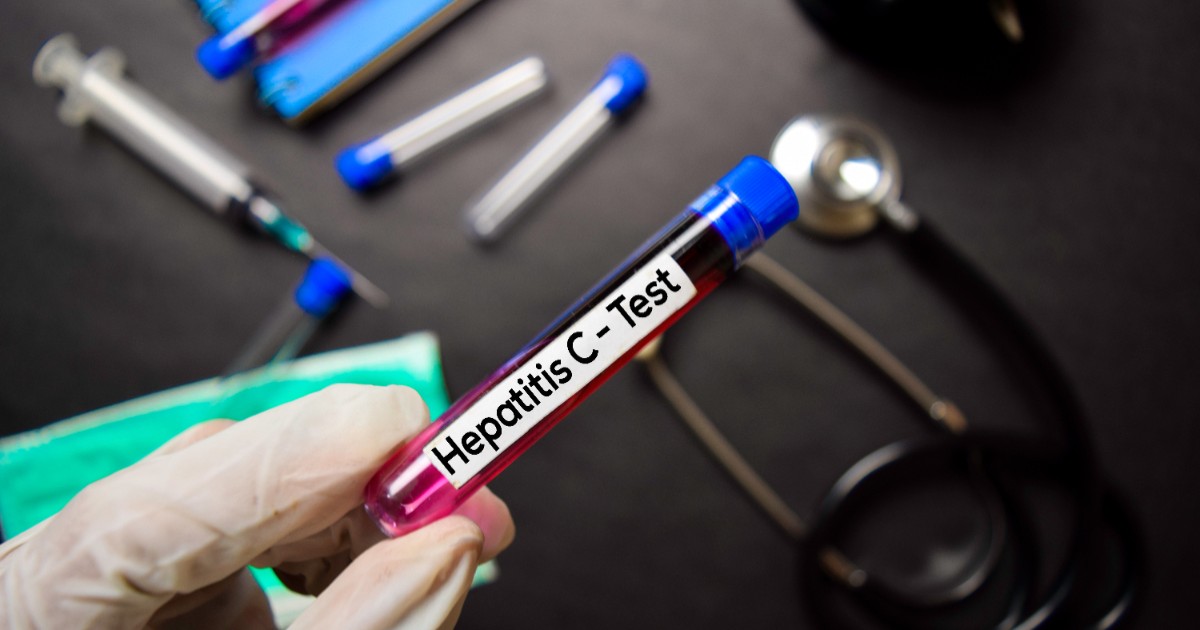 Un doctor care ține în mână un test pentru hepatita C.