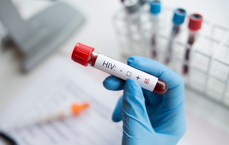 Dublare a numărului de infectări cu HIV la Iași, după pandemie. Explicațiile managerului Spitalului de Boli Infecțioase