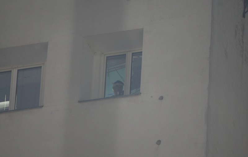 Borcea nu se învaţă minte! A IGNORAT sfatul medicilor, iar ACEASTĂ IMAGINE o arată clar | FOTO