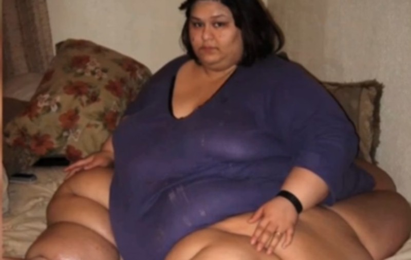 A slăbit 360 de kilograme! CUM ARATĂ ACUM ACEASTĂ FEMEIE | FOTO & VIDEO