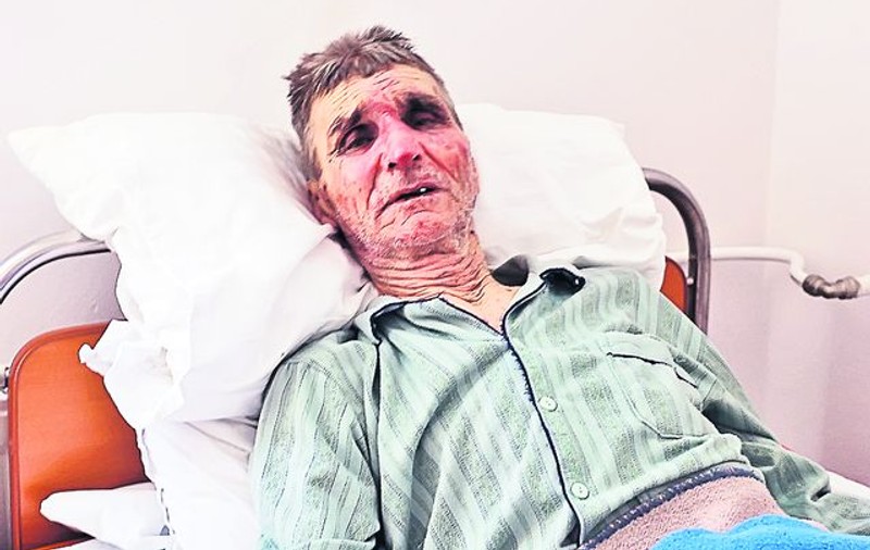 «M-am prefăcut mort ca să scap cu viaţă»