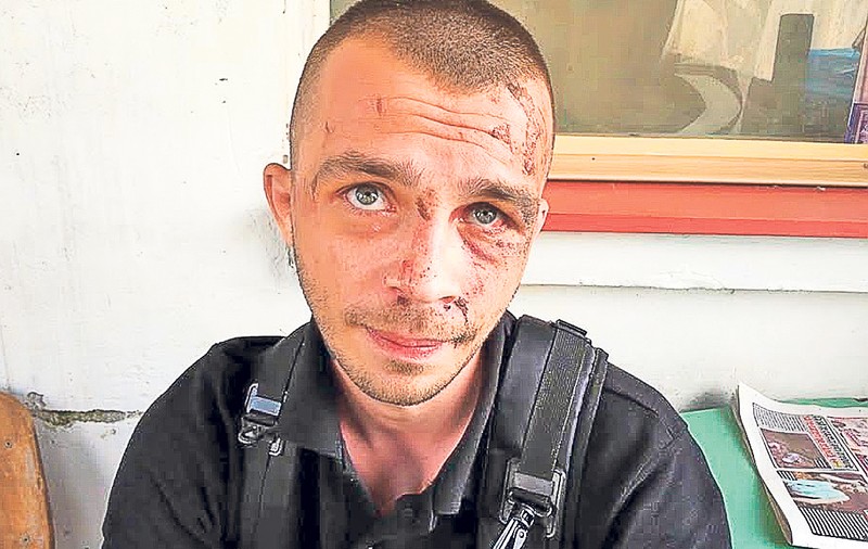 Scandal la spital cu «micul nazist»! Marius Trancă se plânge că a fost bătut de un paznic