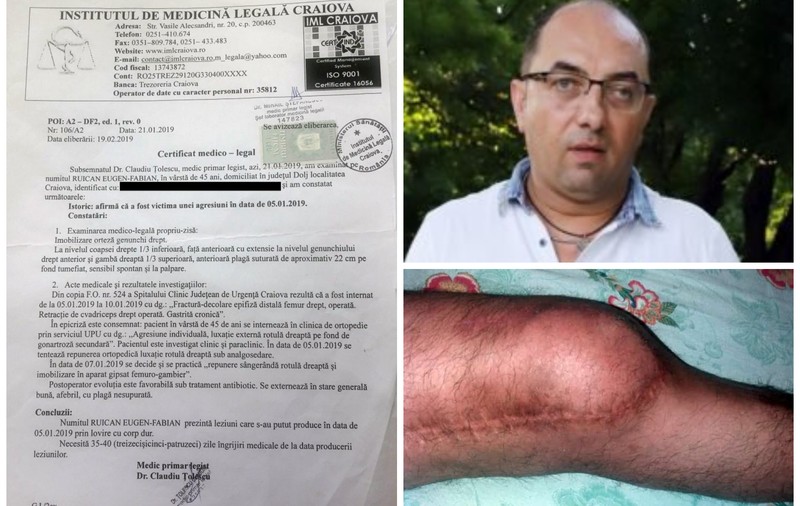 Cum a fost tărăgănat mai bine de un an dosarul unui avocat care s-a ales cu piciorul rupt după ce a reprezentat o clientă