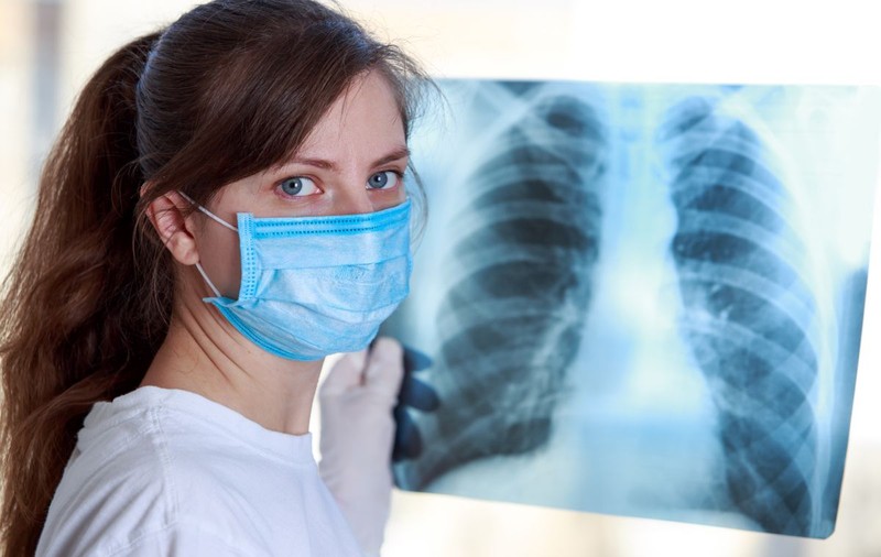 Avertisment al experților chinezi: pacienții asimptomatici COVID-19 pot dezvolta leziuni pulmonare