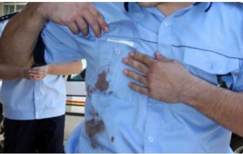 Un polițist a fost mușcat de doi indivizi din Suceava. Agresorii au fost arestați, după ce au folosit și un aparat cu electroșocuri