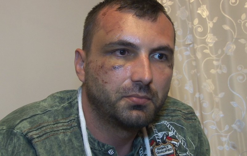 ACUZAȚII GRAVE! Un gorjean susține că a fost bătut de mascați până când i s-a făcut rău