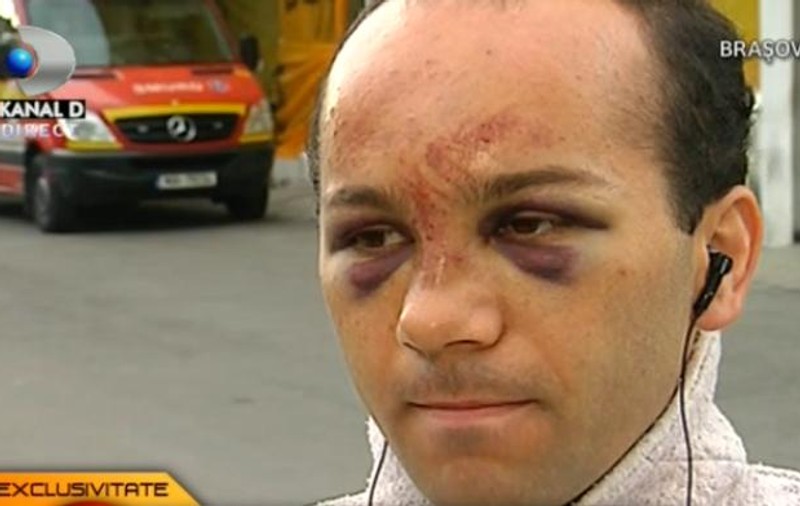 Mircea Balaban, presupusul fiu nelegitim al lui Copos, desfigurat după o bătaie: "Cred că bătaia a fost premeditată"