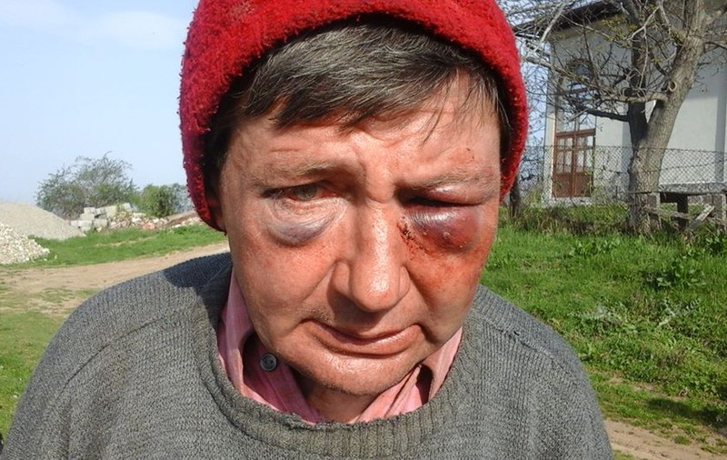 Profesor din Mehedinţi bătut crunt de persoane necunoscute! Au intrat cu toporul peste el în casă!