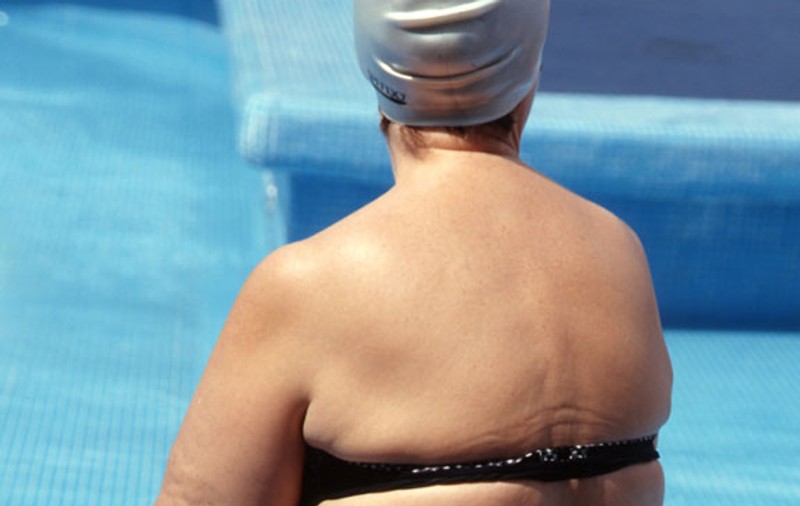 Vrea să slăbească 45 kg, după ce a crăpat cada