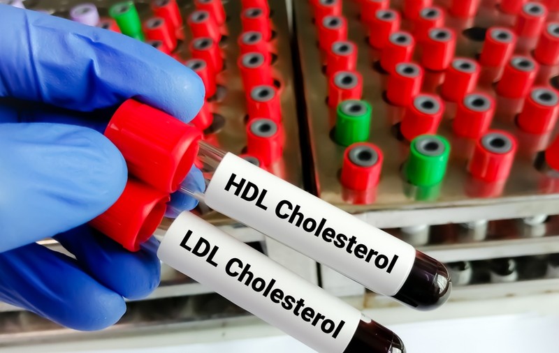 Alimente care ajută la scăderea colesterolului