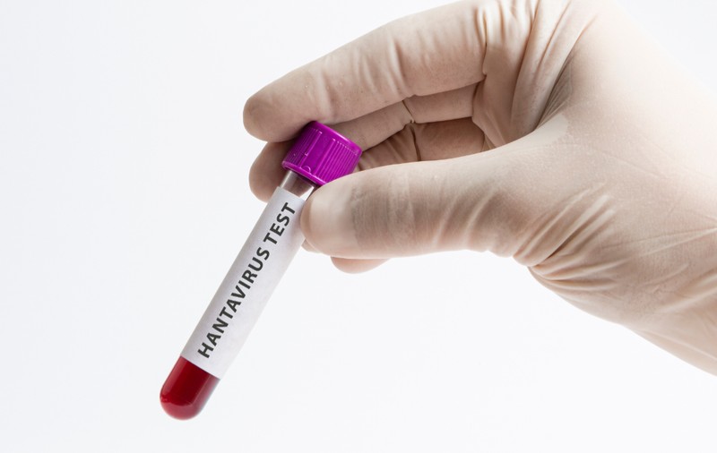 Ce este şi cum se transmite hantavirus. Simptome, tratament, prevenţie
