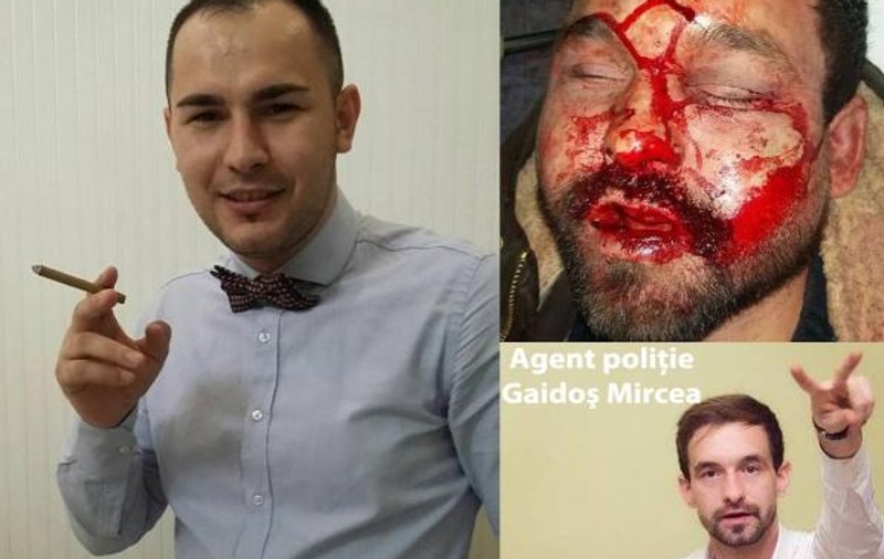 Doi poliţişti din Sălaj s-au bătut după o petrecere. Unul dintre ei este desfigurat
