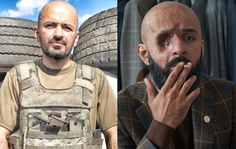Soldat ucrainean care și-a pierdut ochiul drept pe front: „Cel mai rău este când îmi vine să plâng, dar nu mai pot”