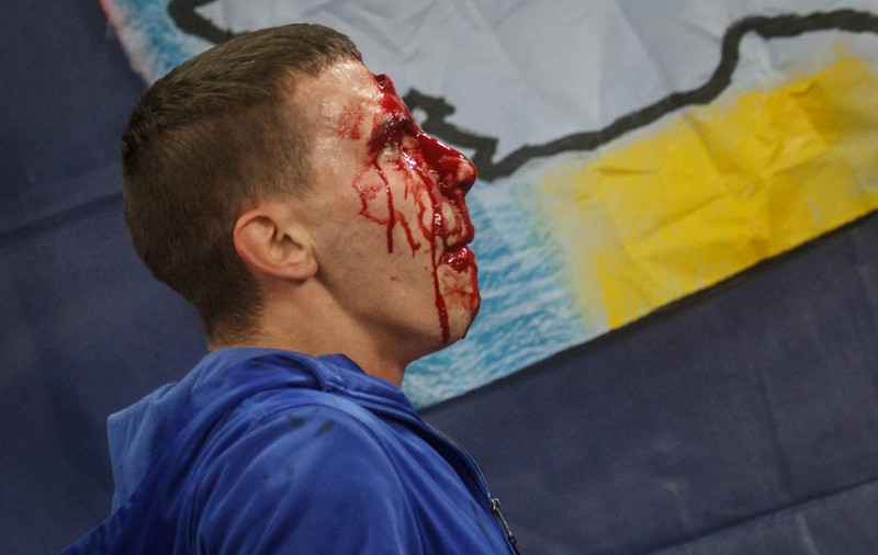 De la ce s-au luat la ciomăgeală, la Budapesta, suporterii echipelor Steaua și Dinamo! ^Totul a pornit de la tricouri! La spital au ajuns doi fani, unul dintre ei fără asigurare medicală. Cum arată una dintre victime / FOTO ÎN ARTICOL