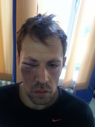 Imre Bucsi a fost bătut chiar la el în oraș FOTO: Facebook