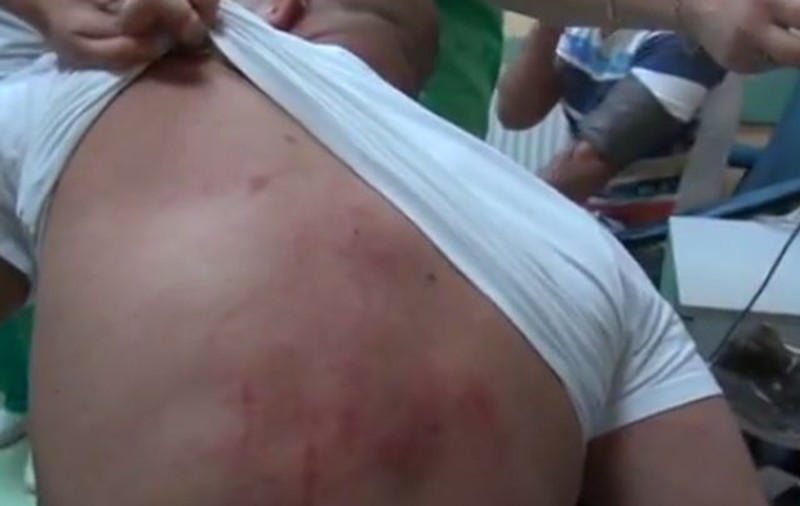 Scandal în Brăila. Fratele unui parlamentar a fost snopit în bătaie de poliţişti VIDEO