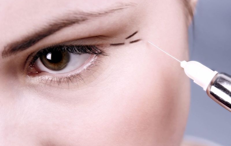 De majorat, i-a dăruit fiicei sale injecţii cu Botox