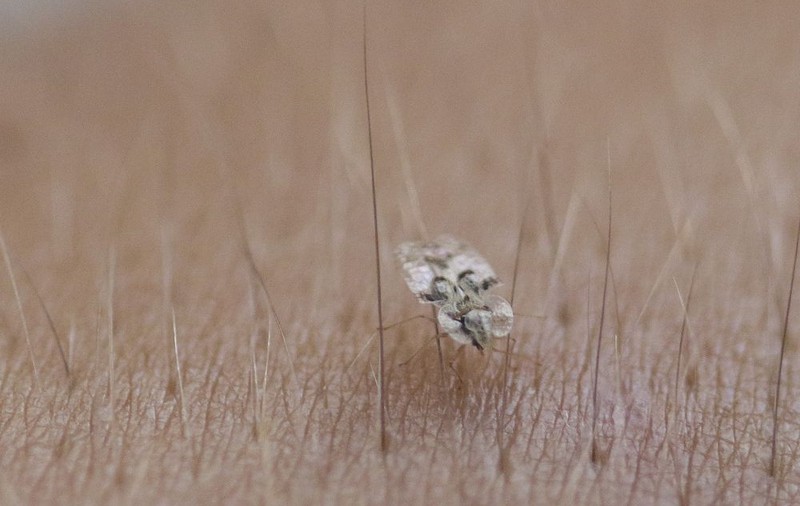 Dosar "Tigrul de platan". "Insecta şi-a dezvoltat abilitatea de a suge sânge uman", dezvăluie medicii din Franţa