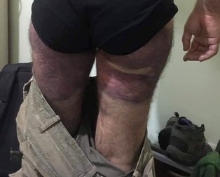 Urmele loviturilor primite de Ionuț Ghiorghe, victima polițiștilor. Sursa foto: pagina de facebook a lui Ionuț Ghiorghe