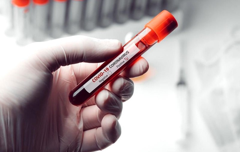 Agenţia de sănătate publică din Germania: Pandemia de coronavirus ar putea dura doi ani. Câţi oameni vor fi infectaţi