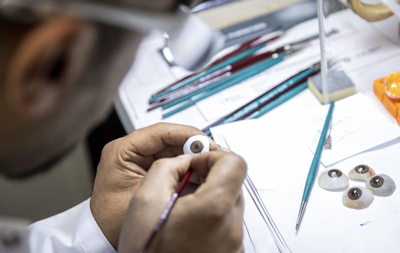 Premieră medicală: un bărbat va primi o proteză oculară realizată la o imprimantă 3D