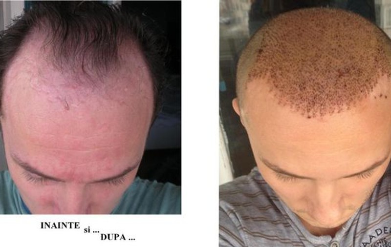 Uite cum arată Trăistariu cu noul păr! Ce diferenţă!