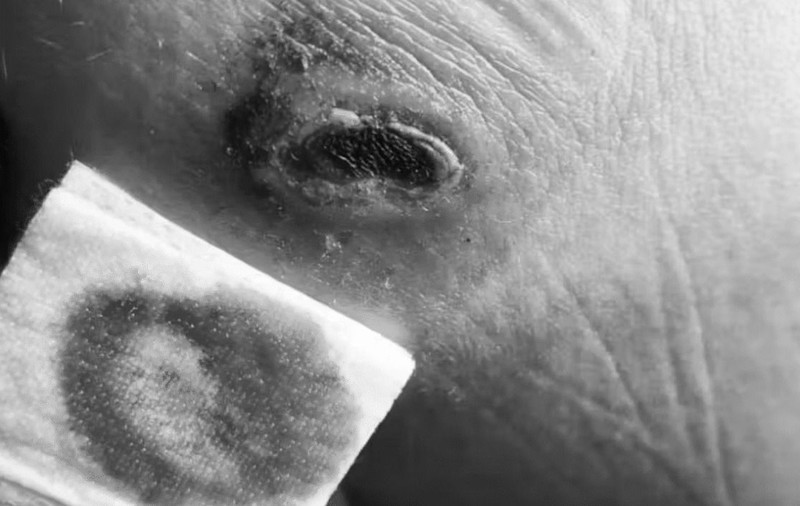 Ce a pățit o tânără din Elveția care a adormit pe încărcătorul de telefon băgat în priză: „Îmi voi face un tatuaj”. Imagini care vă pot afecta emoțional