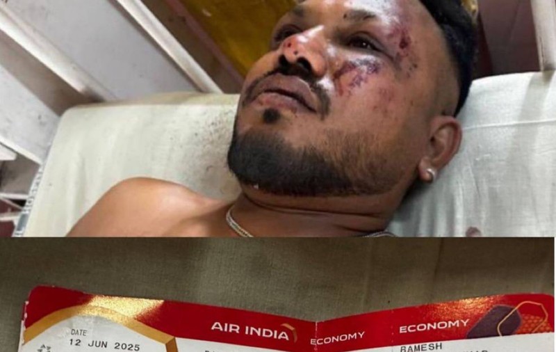 Experții au explicat cum a supraviețuit britanicul Vishwash Ramesh după catastrofa aviatică a Air India